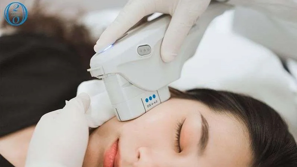 美國音波第二代會痛嗎?專家解密新世代音波拉提技術 舒適度與恢復期全面升級