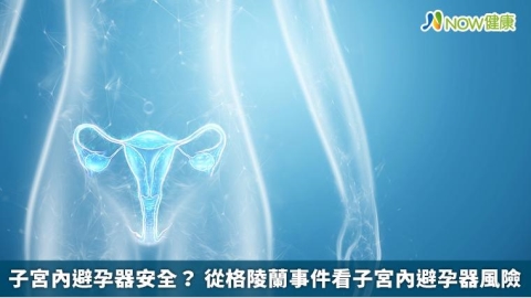 子宮內避孕器安全? 從格陵蘭事件看子宮內避孕器風險