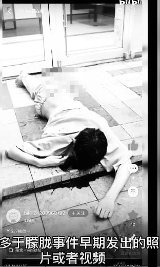 爆驗出多人體液…于朦朧「虐殺影像」暗網流出！付費解鎖「酷刑片」屍檢反轉真相曝