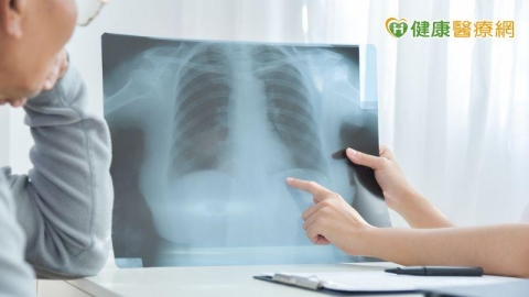 肺癌標靶出現抗藥性!破解迷思才能看見治療新方向