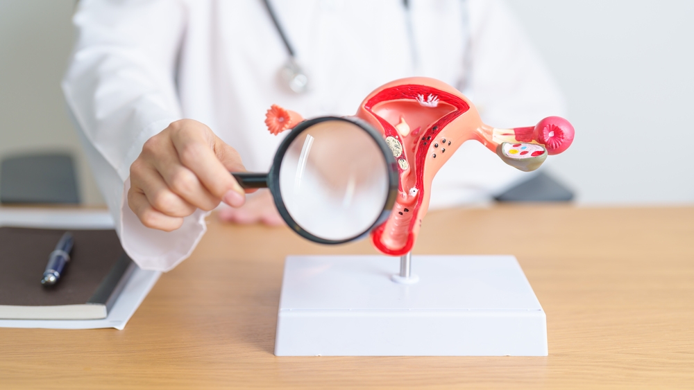 子宮肌瘤飲食懶人包！營養師教你吃對4關鍵，守護荷爾蒙平衡