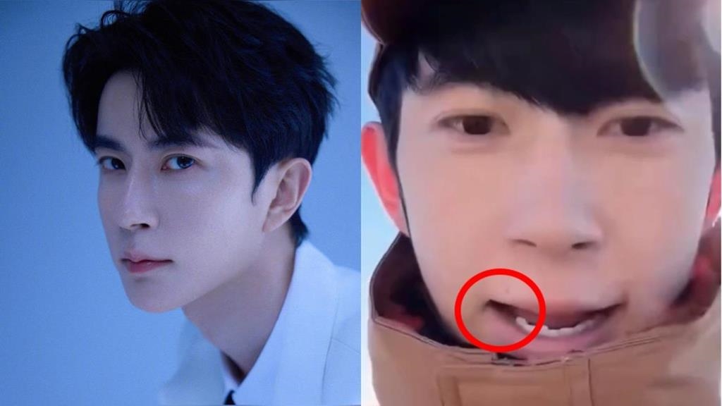 于朦朧才爆「全口無牙、下體撕裂」！生前直播「印證屍檢」網驚：牙齒確實消失了