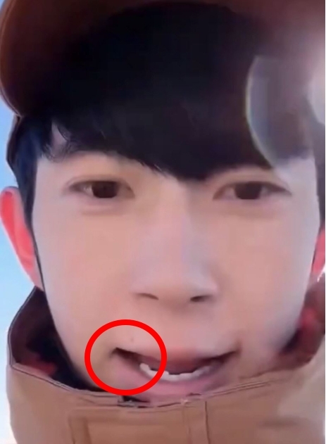 于朦朧才爆「全口無牙、下體撕裂」！生前直播「應證屍檢」網驚：牙齒確實消失了