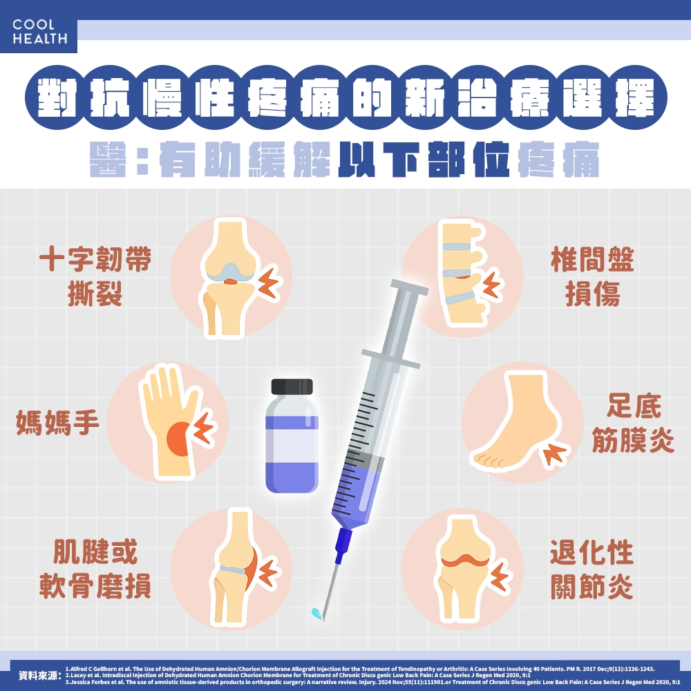 NBA、中職球員都在用！ 醫揭再生療法「羊膜絨毛膜」適用對象：有望不動刀促進修復
