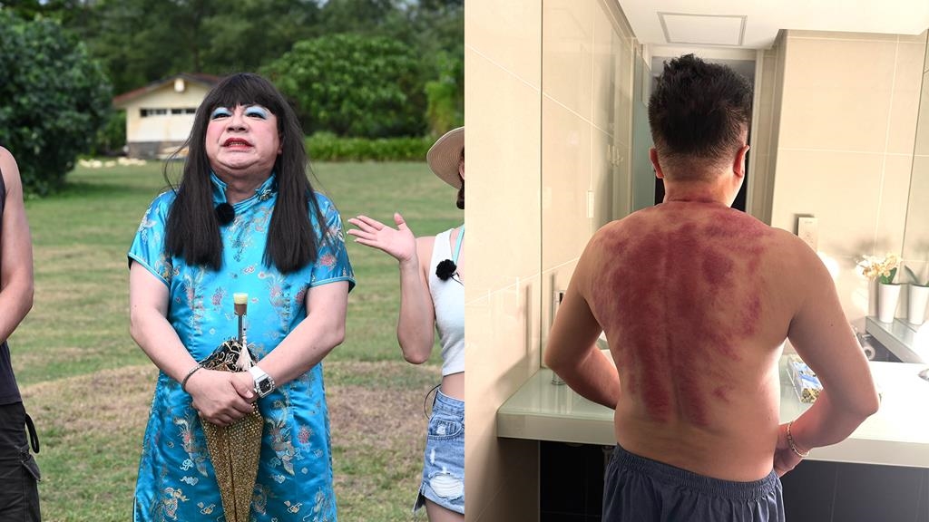 董至成猛曬10小時太陽！錄外景驚覺全身「脫一層皮」曝慘況：2天不能走路