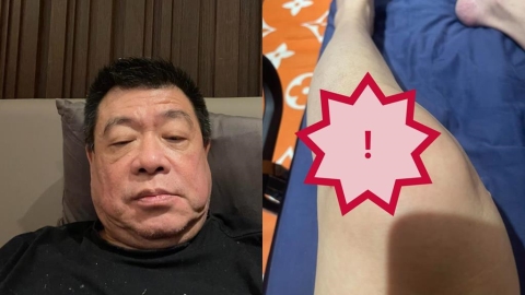 聲援于朦朧收死亡威脅　孫德榮突曬傷勢照曝「4天摔3次」：再跌恐上西天！