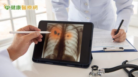 免疫藥物治療加入臨床選項　醫親曝小細胞肺癌治療未來走向