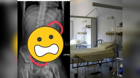 11歲男童3C成癮引「4症狀」急送醫 照X光驚見「排泄物」滿至胸部!