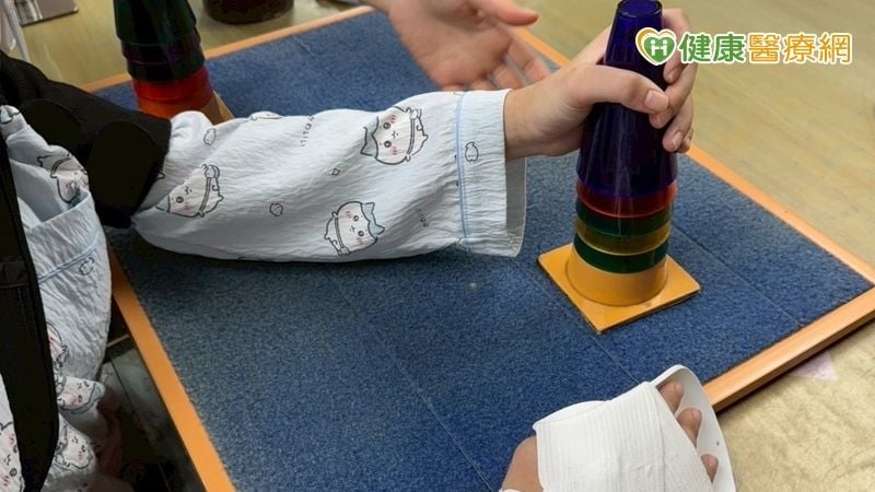 重組大腦神經迴路!限制誘發動作療法助中風患者重拾手部功能