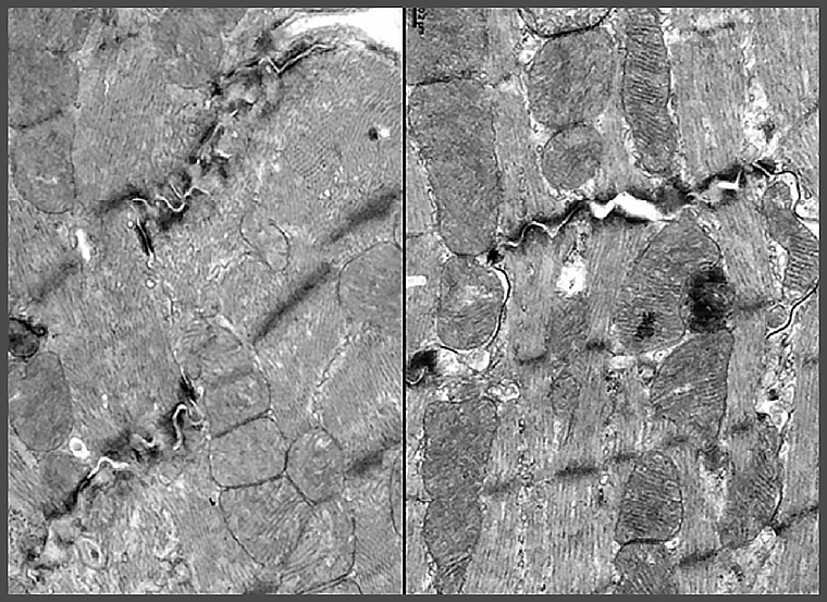 魚與熊掌可望兼得！ 橙皮素能助抗癌治療不再「傷心」
