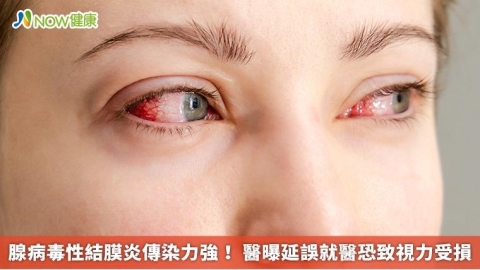 腺病毒性結膜炎傳染力強！ 醫曝延誤就醫恐致視力受損