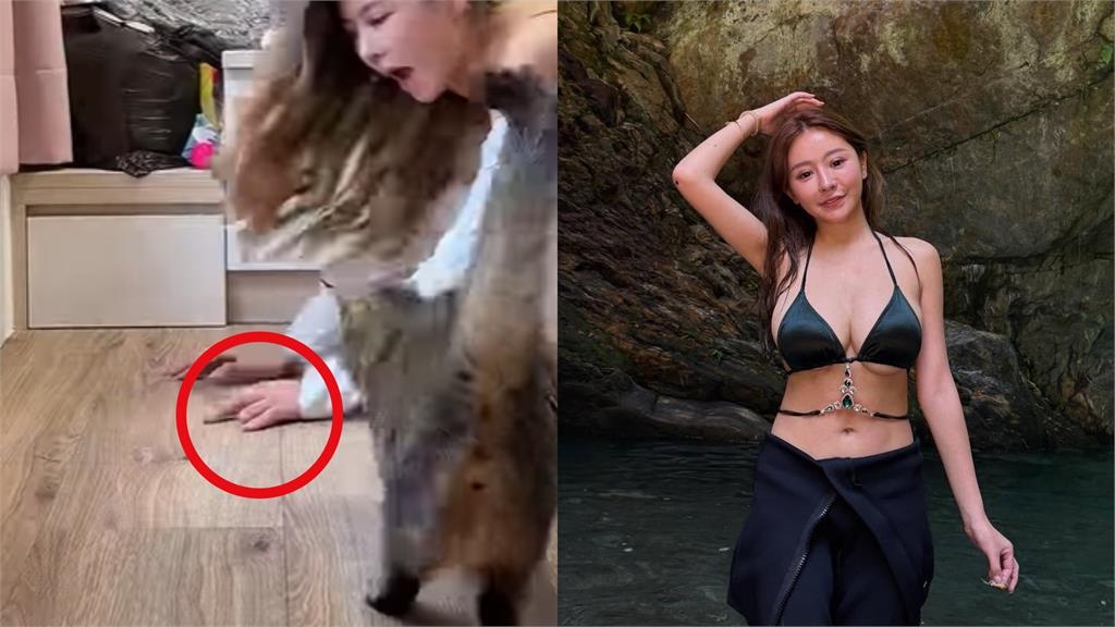 53萬網紅「護理系女神」驚傳國外猝逝！生前自曝「斷指秘辛」：打玻尿酸還比較痛