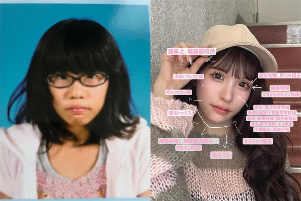 2600萬變臉超值!日本寫真女星公開整容細項 網讚對比照:真的非常努力