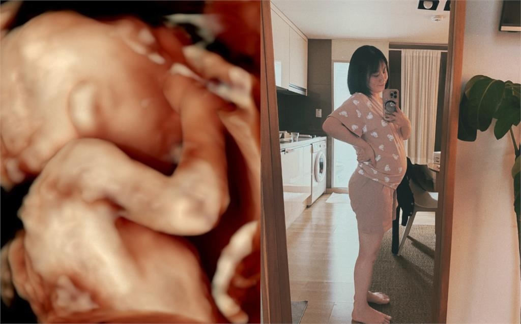 焦凡凡首公開超巨孕肚：好大了！被拍私下「1明顯變化」網驚：我懷孕也是