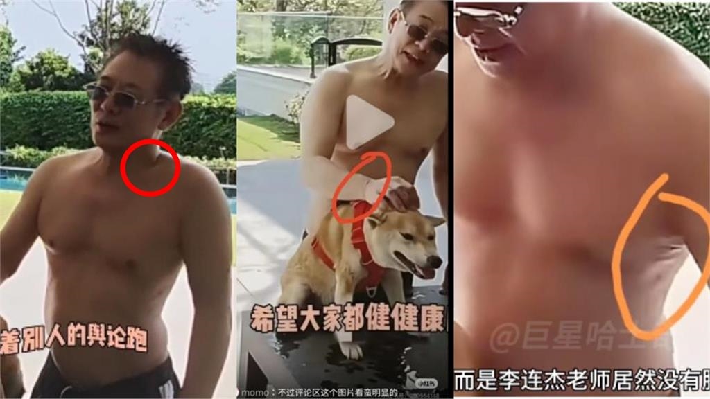 爆挖僧人心臟、手術室脫口「硬件返廠維修」!李連杰「疤痕全消失」1畫面毛骨悚然