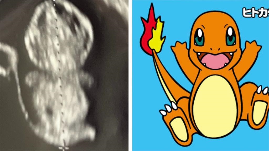 超音波產檢照驚見「小火龍」身影　寶可夢迷笑喊：孩子的媽是噴火龍吧！