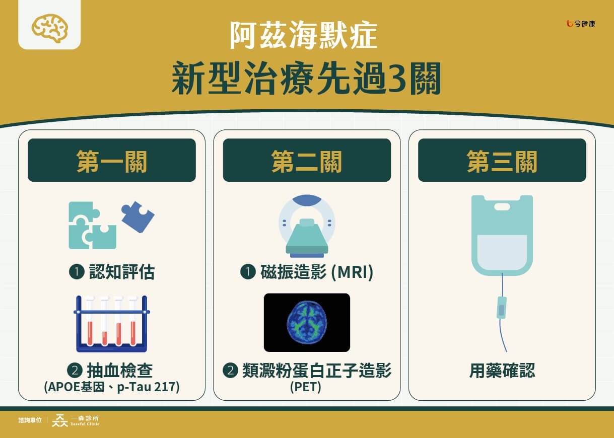 阿茲海默症新藥現曙光!早期介入可望延緩失智