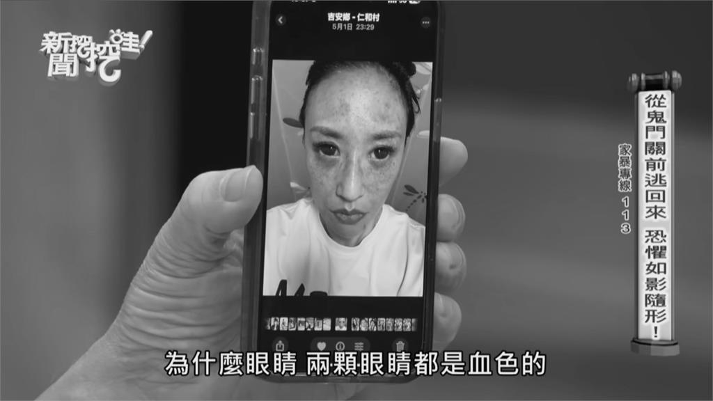 昔甜喊國手尪1天6次!安歆澐曝被髮勒脖「雙眼爆血」驚悚照…余祥銓、薔薔開挺了