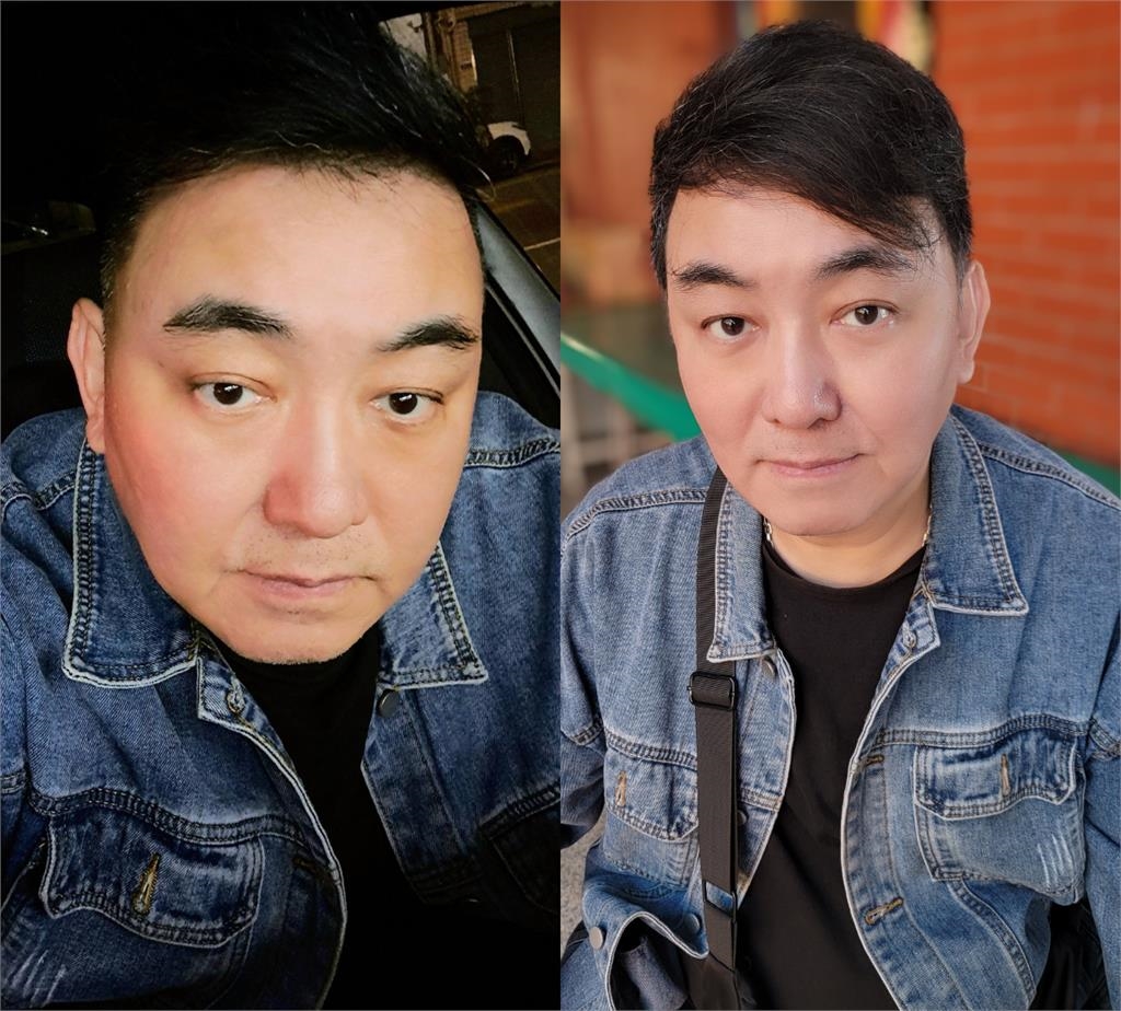 《意難忘》徐亨腦腫瘤「自爆0通告」欠2億還債近況!萬網心疼關切…本人親回應了