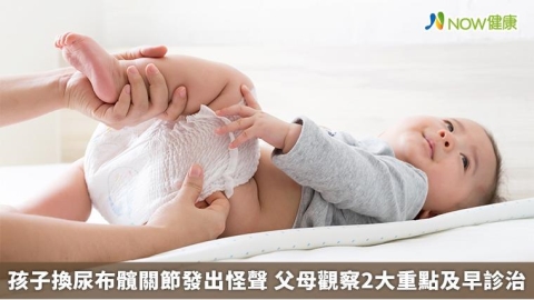孩子換尿布髖關節發出怪聲 父母觀察2大重點及早診治 