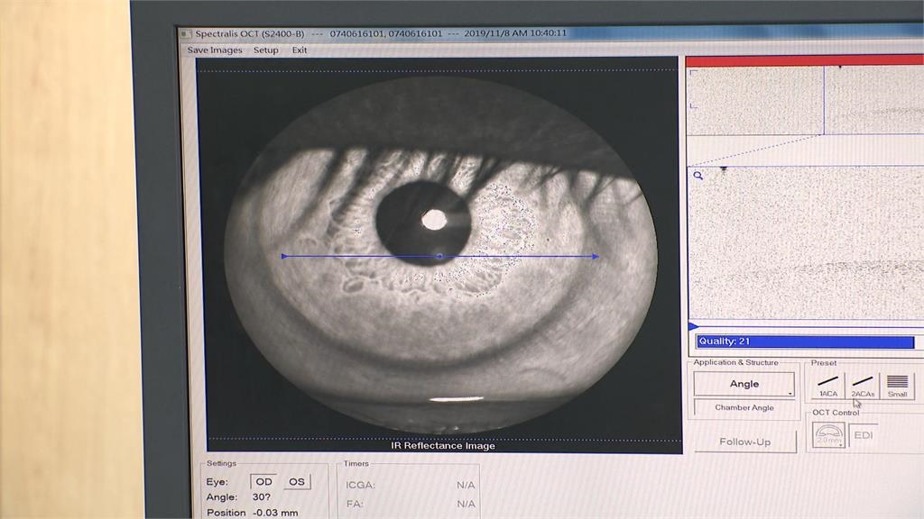 偏郷眼科醫療資源不足! 彰化秀傳醫院啟動"點睛計劃"