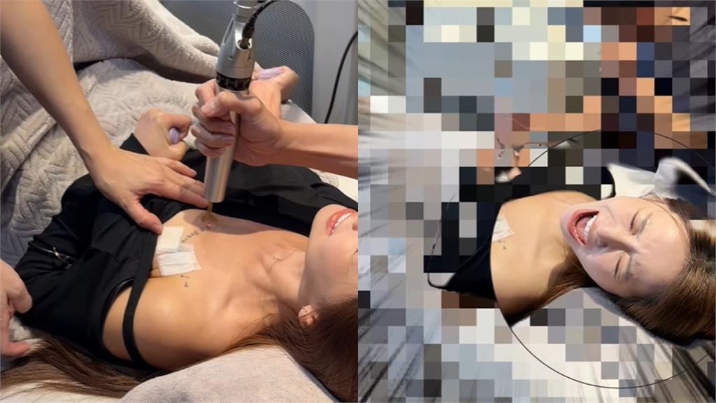 啦啦隊女神「強忍50倍痛」做這事！認了「工作受影響」：想要身上乾淨些