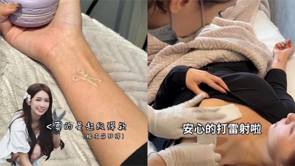 啦啦隊女神「強忍50倍痛」做這事！認了「工作受影響」：想要身上乾淨些