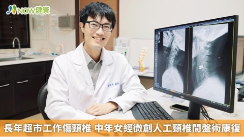 長年超市工作傷頸椎 中年女經微創人工頸椎間盤術康復