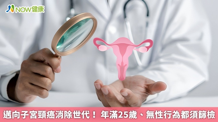  邁向子宮頸癌消除世代！ 年滿25歲、無性行為都須篩檢