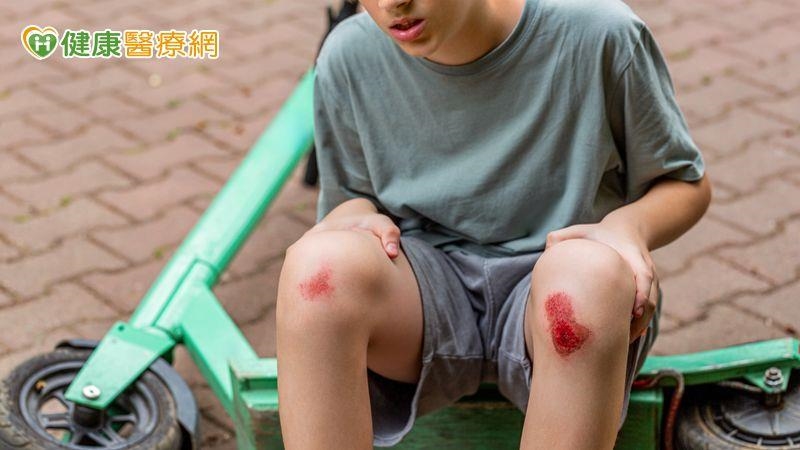 傷口癒合不是結束　預防疤痕從「這時機」開始！醫揭疤痕凝膠應用策略