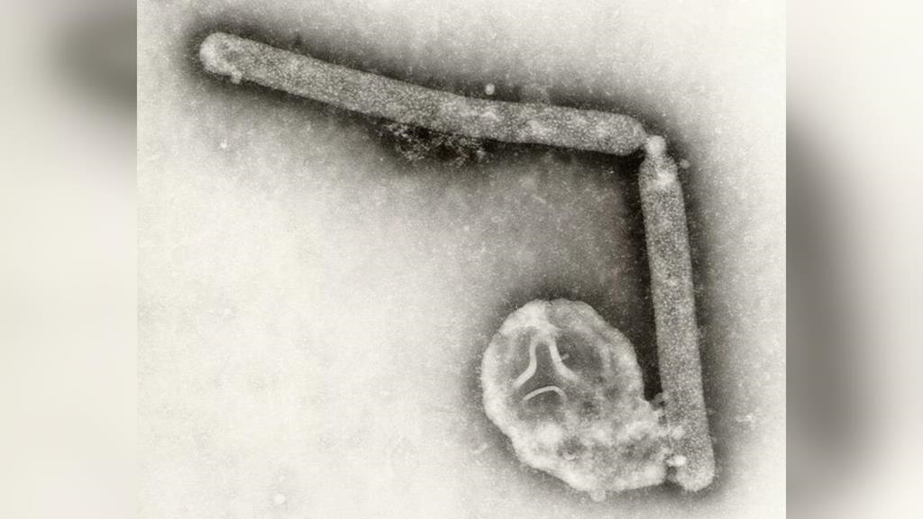 美國爆H5N5禽流感全球首例人類死亡　疾管署：列第一級旅遊警示