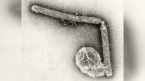 美國爆H5N5禽流感全球首例人類死亡 疾管署:列第一級旅遊警示