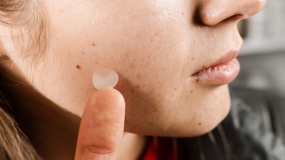 點痣後怎麼照顧？專家揭4大保養建議，避開6禁忌讓恢復更安心！