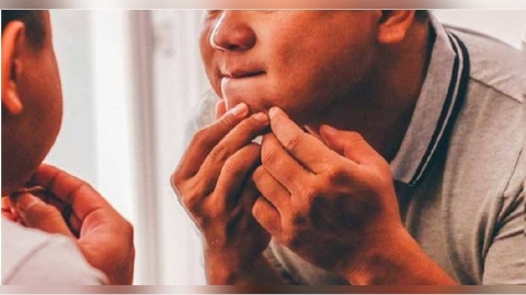 大二生擠痘痘慘了！「肺部穿十多洞」部份壞死　醫示警：這部位別亂擠