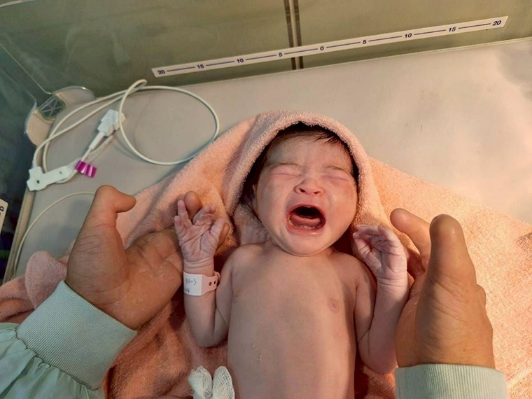 精準醫療終止3根手指罕病遺傳 龍蝦爪畸形父迎健康女