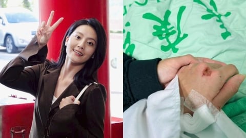 顏曉筠遭汽車「撞飛倒地」傷勢嚴重急動手術!嘆按下暫停鍵《好運來》後續動向曝