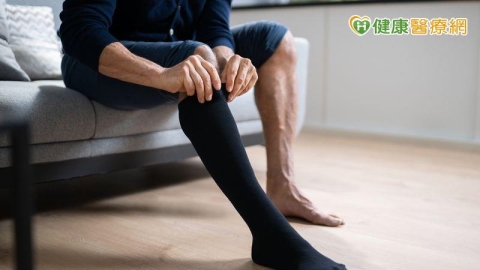 久坐久站族注意!嚴重靜脈曲張恐致潰瘍 及早治療助恢復步行