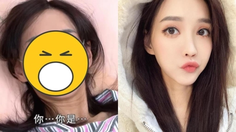 八點檔女神「車禍毀容」花500萬重塑!徐千京223字吐心聲:手術逾10次…
