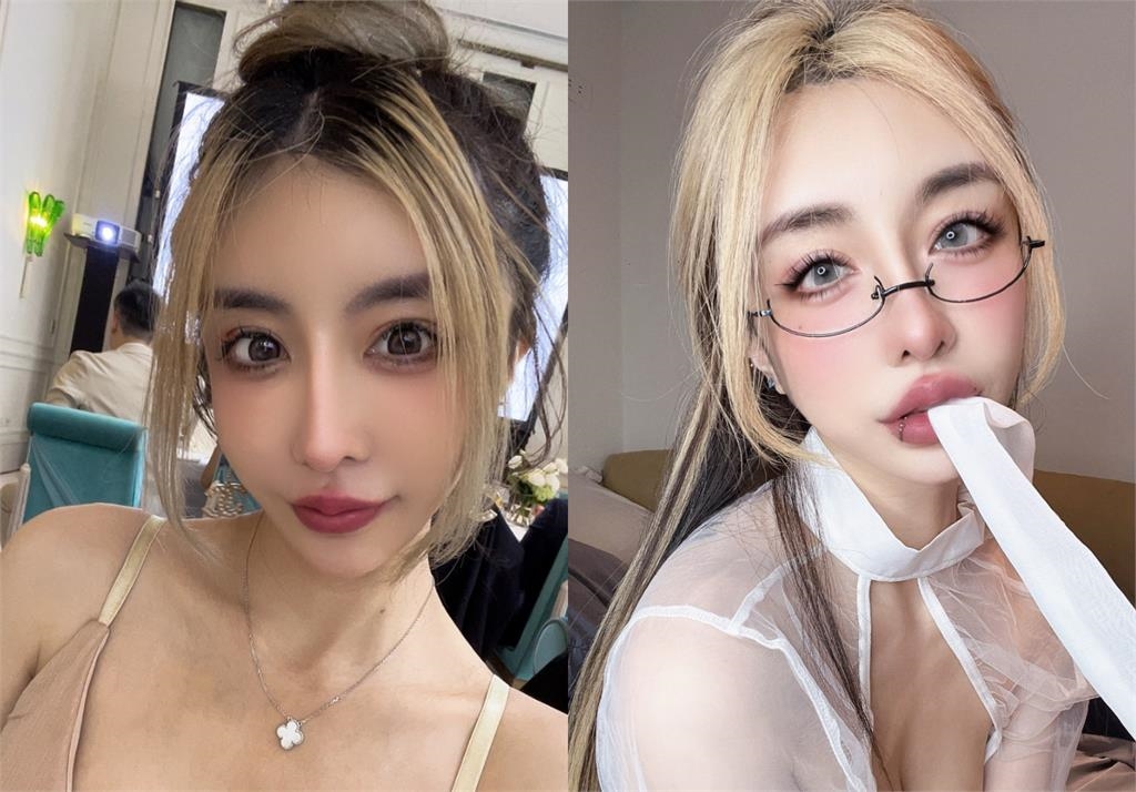 雪碧砸近千萬整形「眼睛留下後遺症」！她崩潰喊「像被針插」慘況曝光