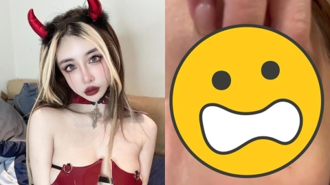 雪碧砸近千萬整形「眼睛留下後遺症」!她崩潰喊「像被針插」慘況曝光