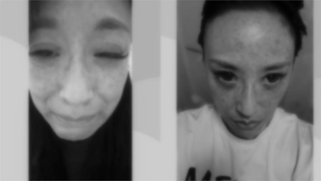 安歆澐突發不自殺聲明!公開遭尪勒脖「血管大爆裂」傷勢照:還是擔心被傷害