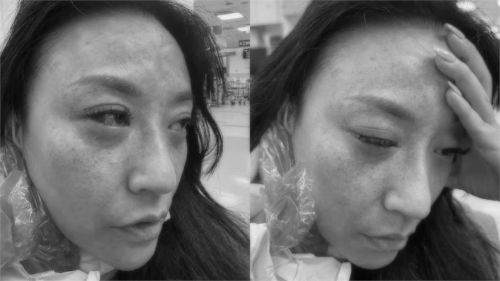 安歆澐突發不自殺聲明!公開遭尪勒脖「血管大爆裂」傷勢照:還是擔心被傷害