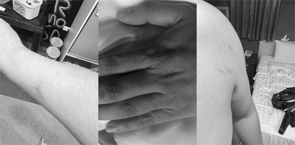 商旅「天花板整片崩塌」他躺床遭砸!妻氣炸曬「超扯畫面」業者急喊聲了