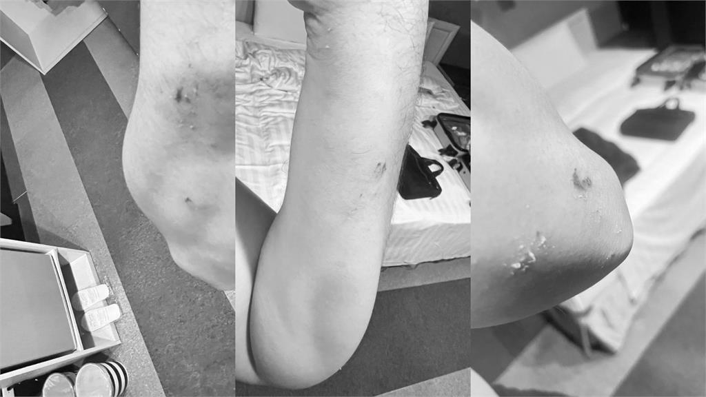 商旅「天花板整片崩塌」他躺床遭砸!妻氣炸曬「超扯畫面」業者急喊聲了