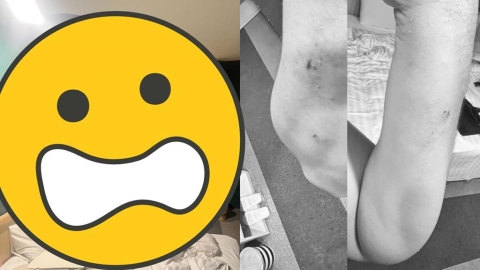 商旅「天花板整片崩塌」狠砸躺床旅客!妻氣炸曬「超扯畫面」業者急喊聲了