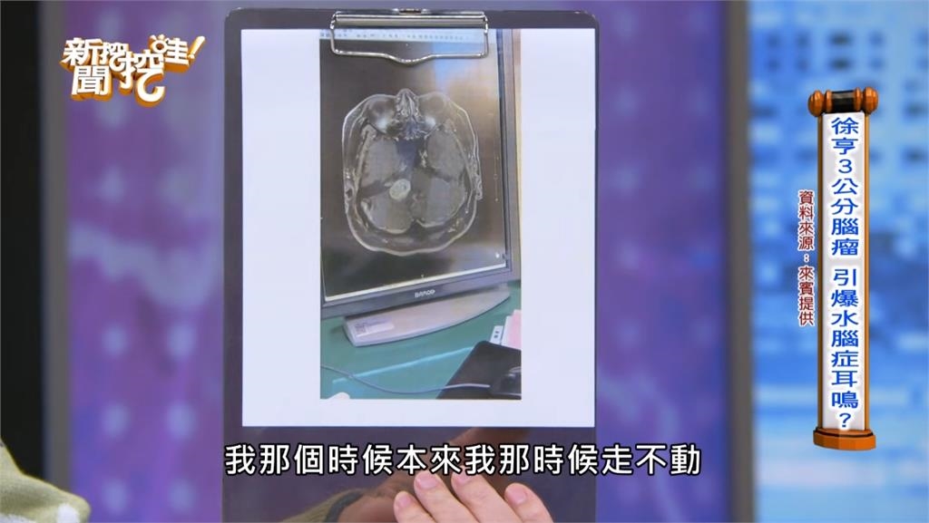 59歲徐亨長3cm腦瘤靠「1裝置維生」掀開嚇壞全場！親揭「不去中國發展」真相