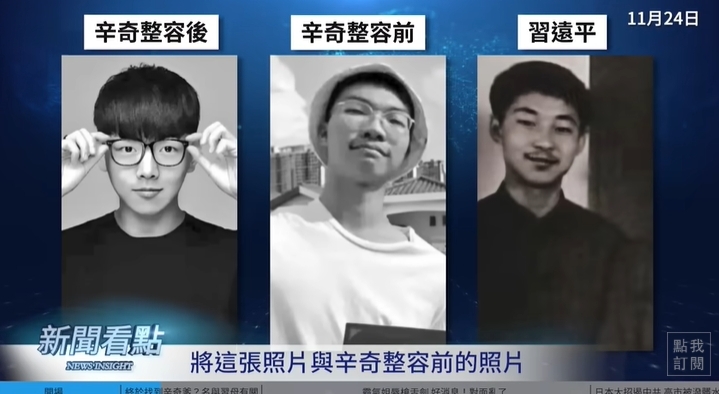 于朦朧遭爆「戴矽膠假耳」畫面曝！他曬右臉「辛」字烙印照：盼于粉出面