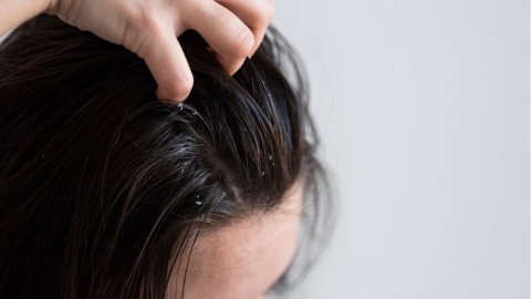 頭皮的冬季隱形危機：乾癢、雪花、髮絲脆弱？專家分享換季頭皮養護重點