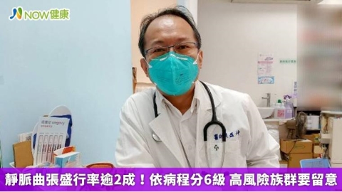 靜脈曲張盛行率逾2成!依病程分6級 高風險族群要留意