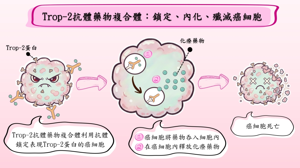 荷爾蒙受體陽性（HR+）晚期乳癌漫漫長路，Trop-2抗體藥物複合體新藥納健保帶來治療新轉機